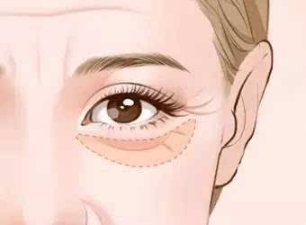 眼周保养揭秘：哪款眼霜抗皱效果好？ 