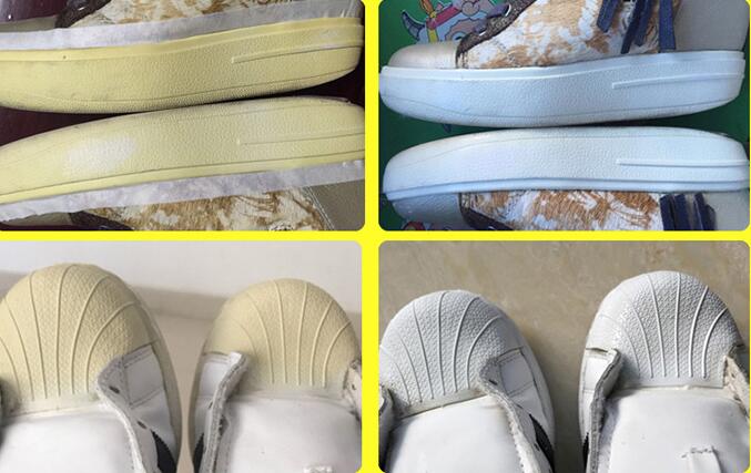 白鞋底发黄用什么方法可以变白